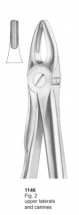  Fig. 2 upper laterals and canines 